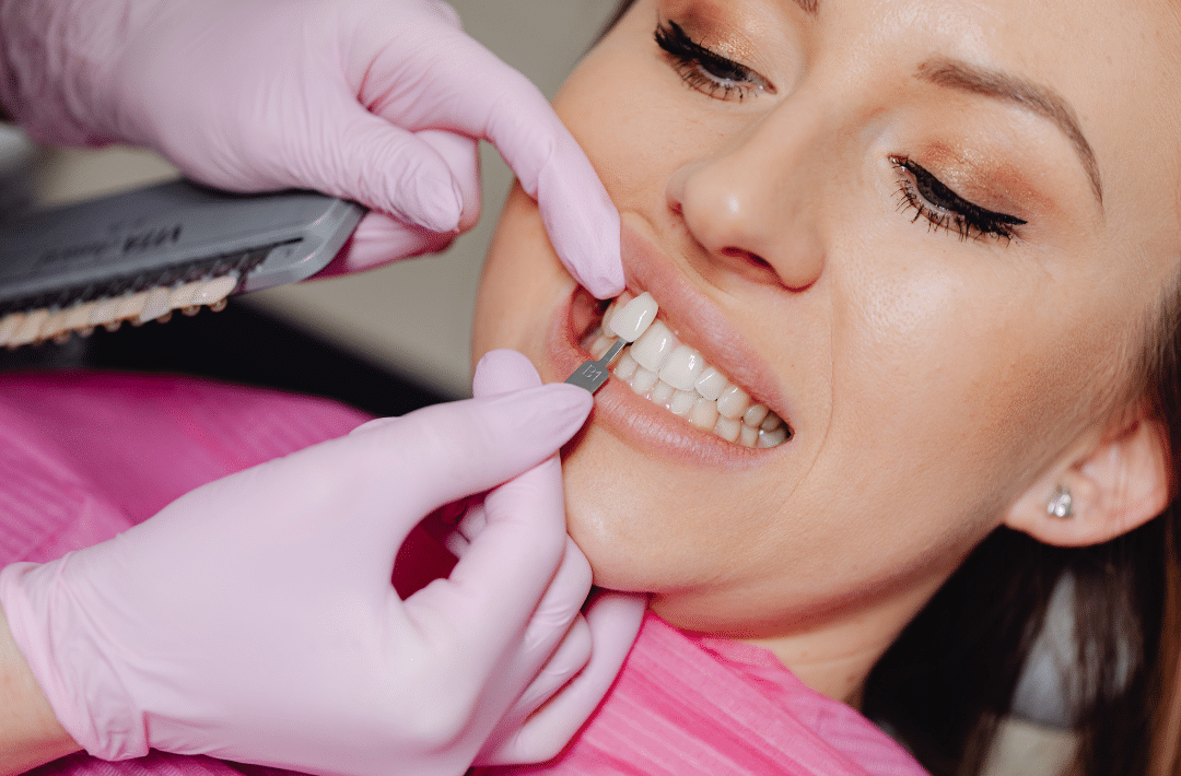A dental professional in pink gloves holding a porcelain veneer sample against a patient's natural teeth to ensure a perfect color match.