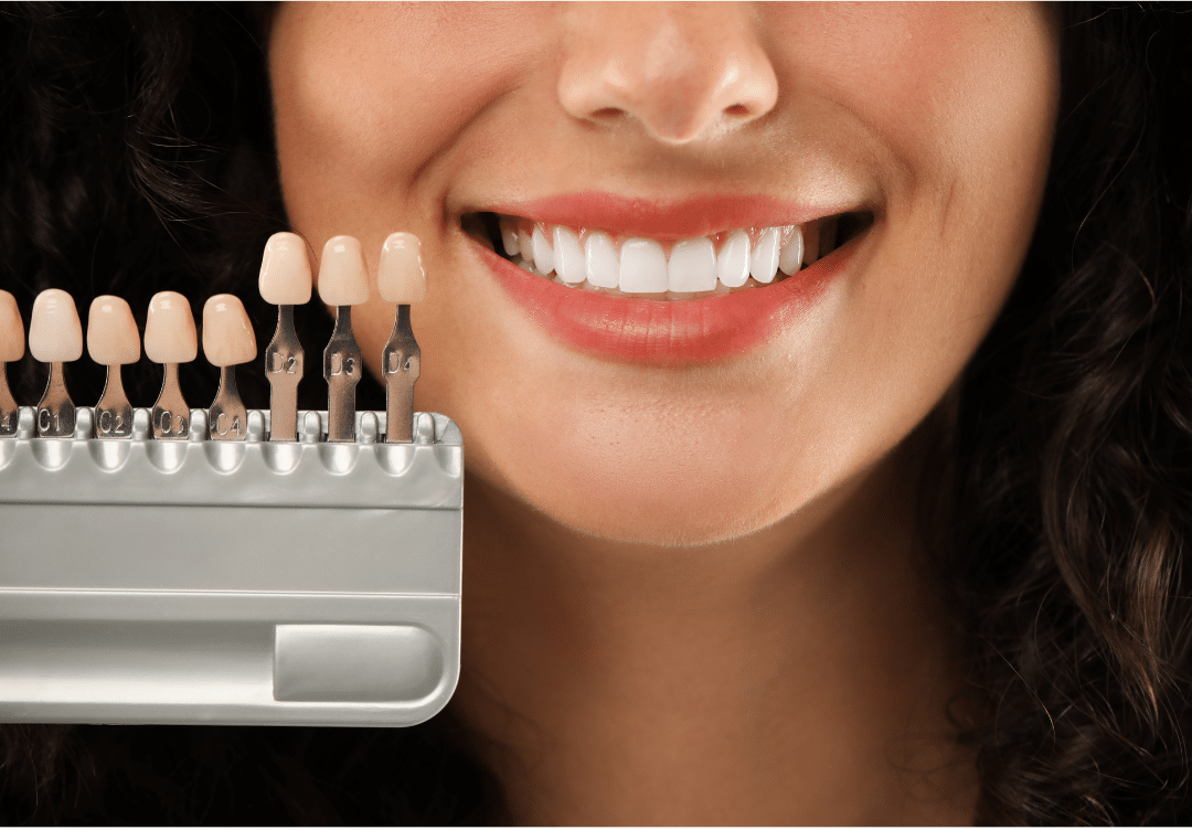 A dentist holding a professional shade guide next to a patient's bright smile to ensure a porcelain veneer blends seamlessly with natural teeth.