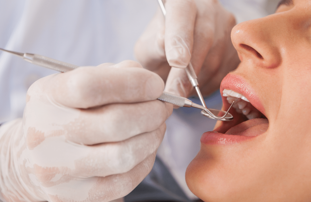 A dentist performing a clinical examination on a patient, representing the precise assessment required for custom inlays and onlays.