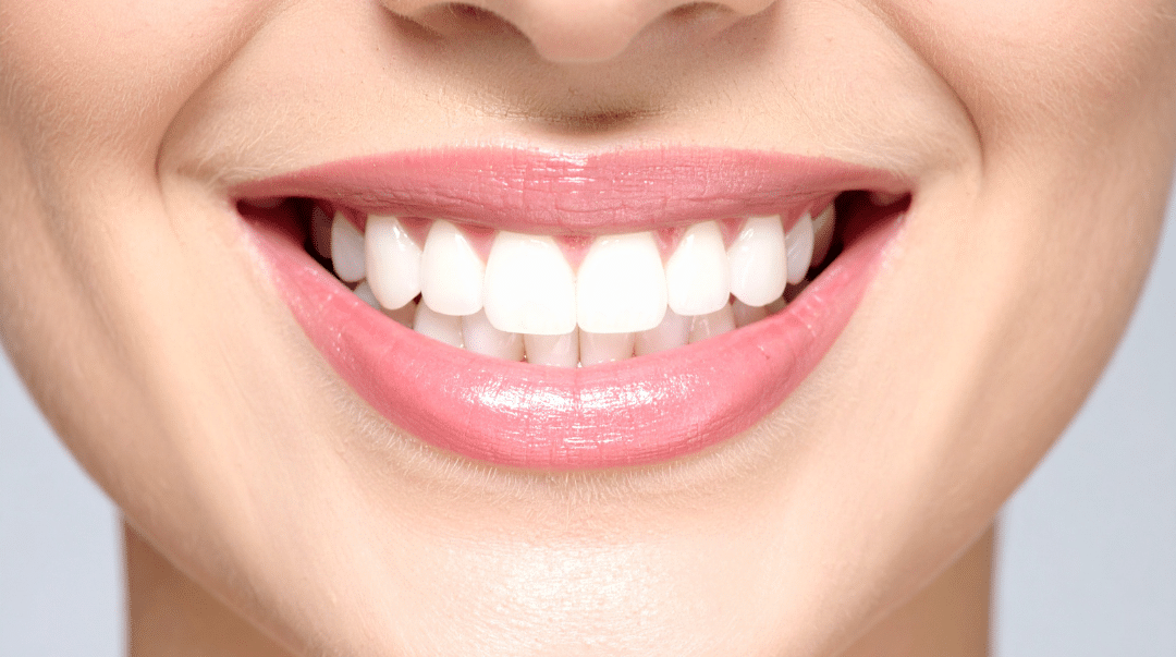 A close-up of a person with a bright, perfectly aligned, and confident smile.