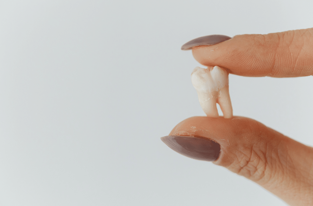 A dental professional holding an extracted natural human molar tooth between their fingers.